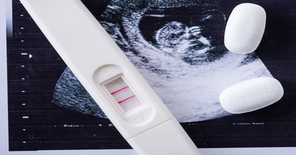 A positive pregnancy test, an ultrasound image of a 1st trimester baby and two abortion pills.